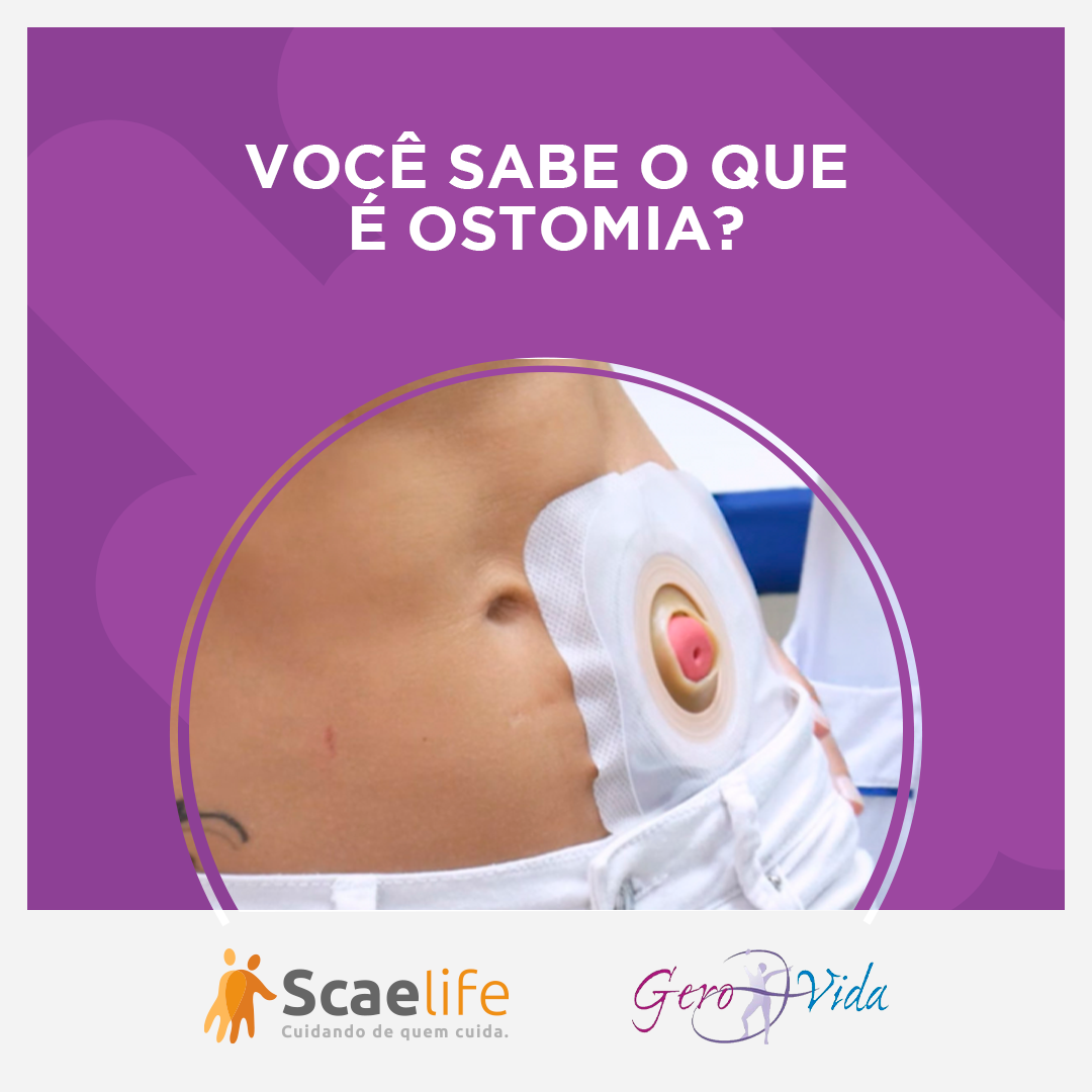 Blog Da Gigi Você Sabe O Que é Ostomia 3028